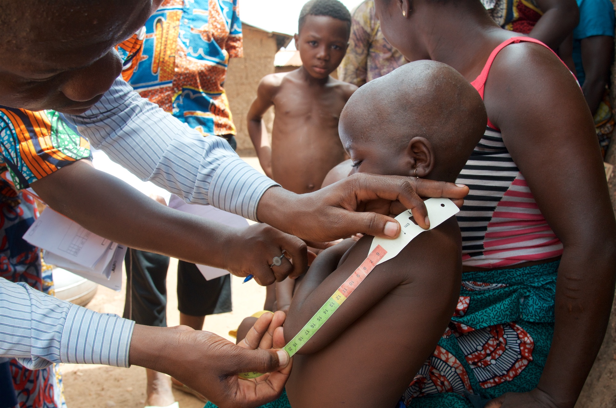 Benin child health checkup. © World Bank